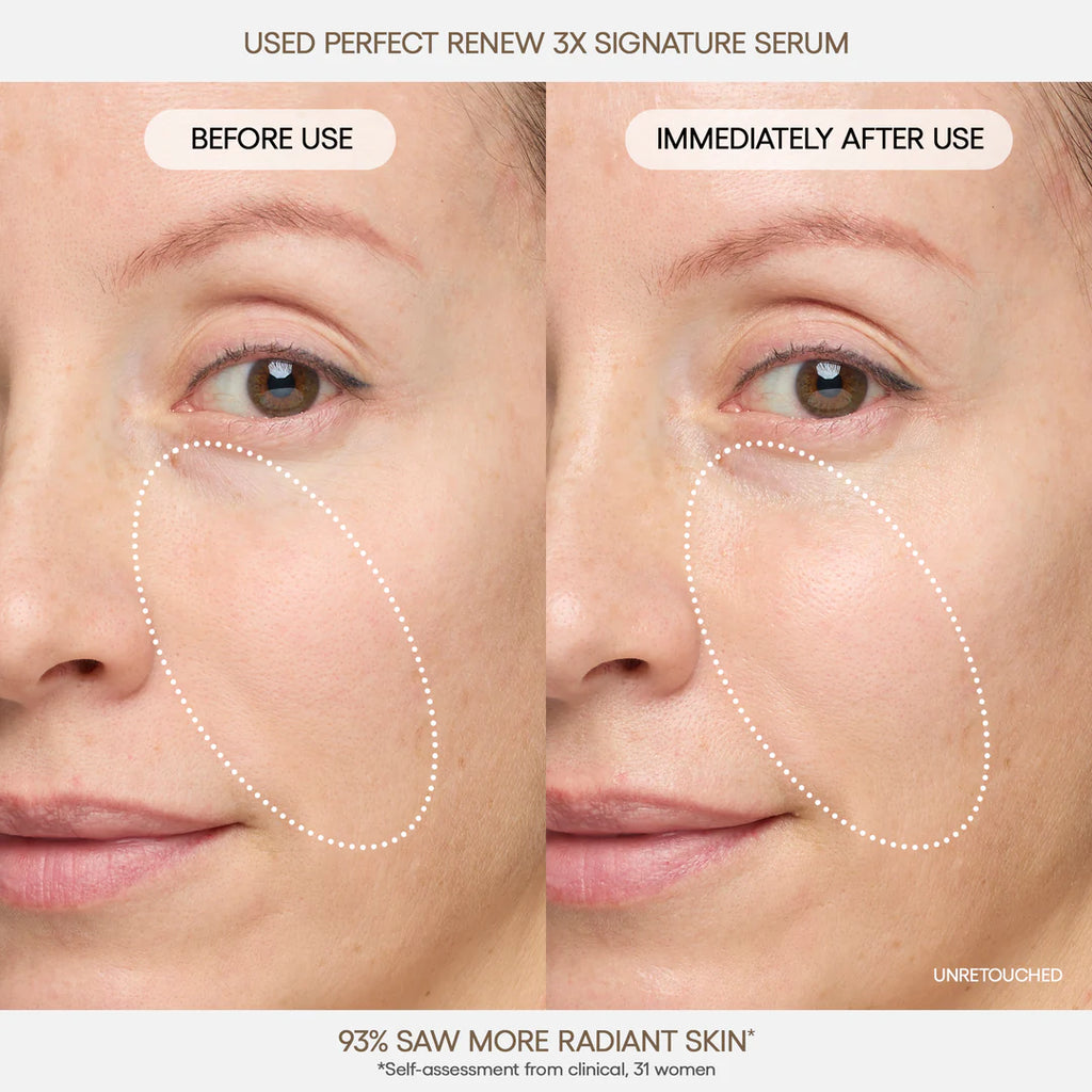 Perfect Renew 3X Signature Serum 40ml