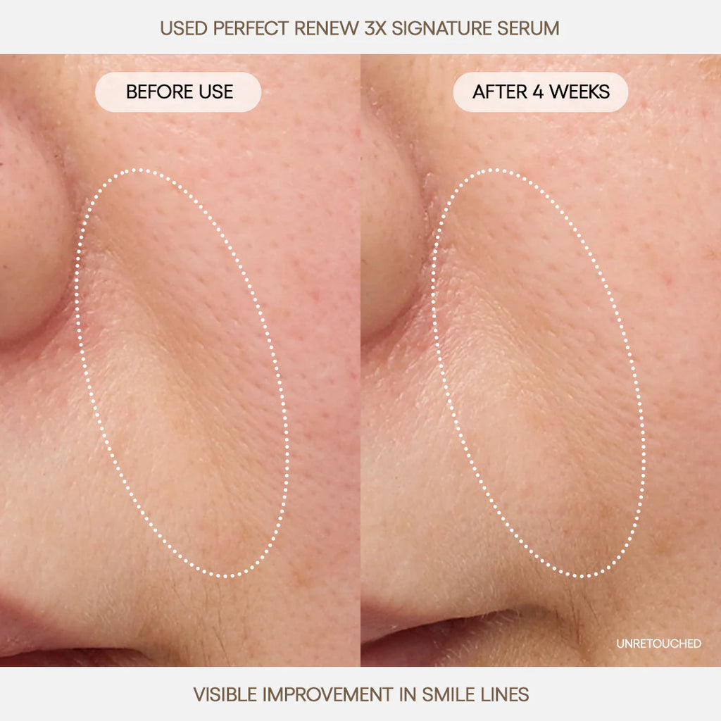 Perfect Renew 3X Signature Serum 40ml